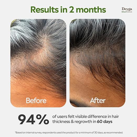 Hair Growth Oil – Natural Ayurvedic Hair Oil for Hair Fall Control, Thicker & Stronger Hair Growth | Herbal Scalp Nourishing Oil