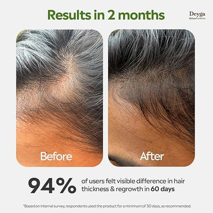 Hair Growth Oil – Natural Ayurvedic Hair Oil for Hair Fall Control, Thicker & Stronger Hair Growth | Herbal Scalp Nourishing Oil