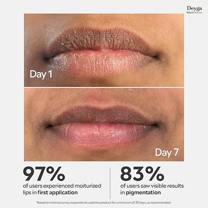 Beetroot Lip Balm – Natural Moisturizing Lip Care for Soft, Hydrated & Pink Lips | 100% Natural Lip Balm for Daily Use